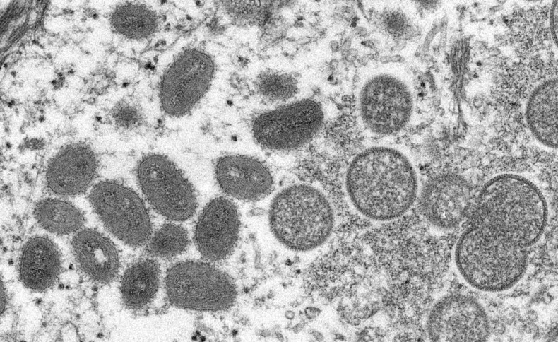 An electron microscopic (EM) image shows mature, oval-shaped monkeypox virus particles as well as crescents and spherical particles of immature virions, obtained from a clinical human skin sample associated with the 2003 prairie dog outbreak in this undat