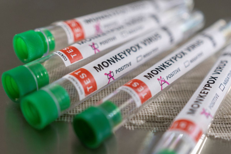 Test tubes labelled "Monkeypox virus positive" are seen in this illustration taken May 22, 2022. 