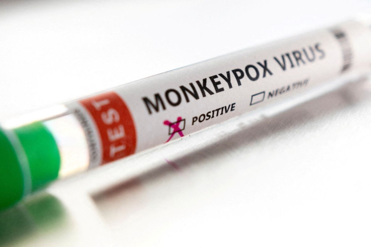Test tube labelled "Monkeypox virus positive" is seen in this illustration taken May 22, 2022. 