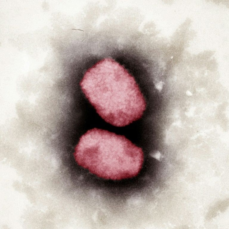 A file photo from 2001 shows a colored electron-microscopic capture of the monkeypox virus