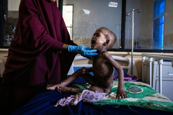 Aid agencies have raised less than 20 percent of the funds needed to prevent a famine