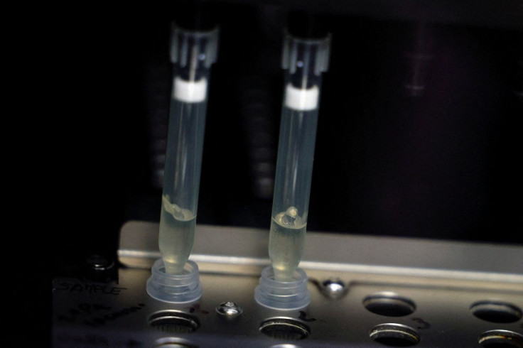 Two samples of suspected cases of monkeypox go through a process of nucleic acid extraction as they get tested at a microbiology lab at La Paz Hospital in Madrid, Spain, June 1, 2022.