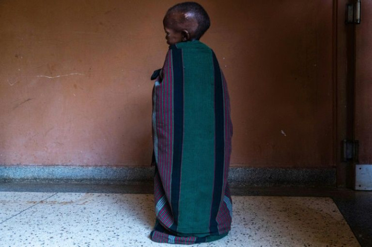 A malnourished child waits in a hospital in Moroto in the long-suffering Karamojo region of Uganda