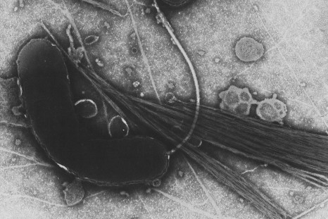 Vibrio Cholerae/Cholera