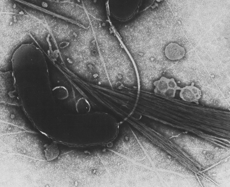 Vibrio Cholerae/Cholera