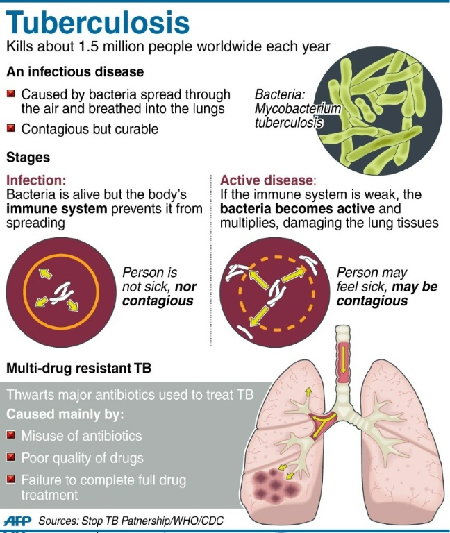 'Beginning Of The End': Patients Hail New Treatment For Drug-resistant TB