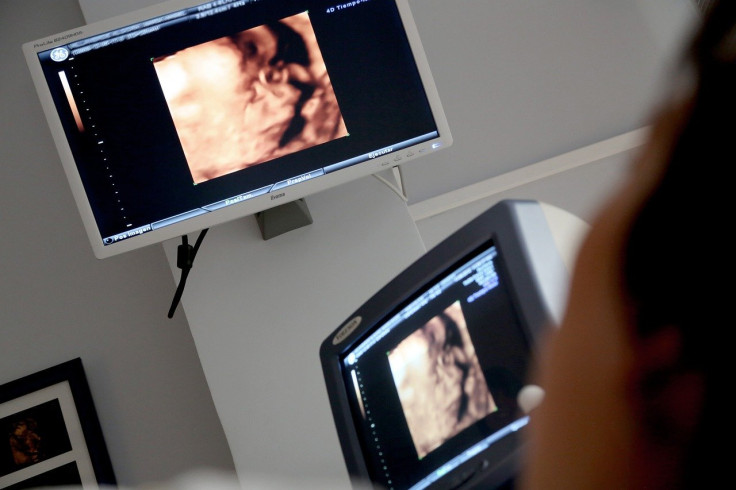 Ultrasound, Fetus, Baby,