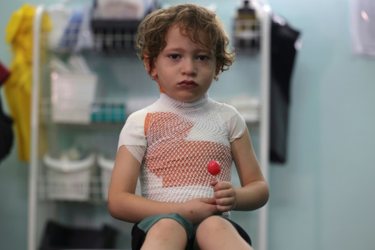 More than a third of the burns patients treated at MSF clinics across Gaza were aged under five