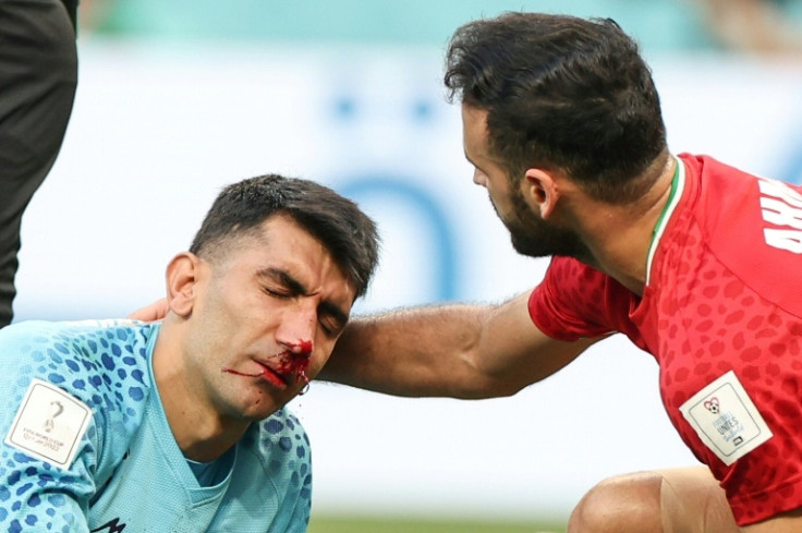 Iran's goalkeeper Alireza Beiranvand suffered a broken nose in the England match