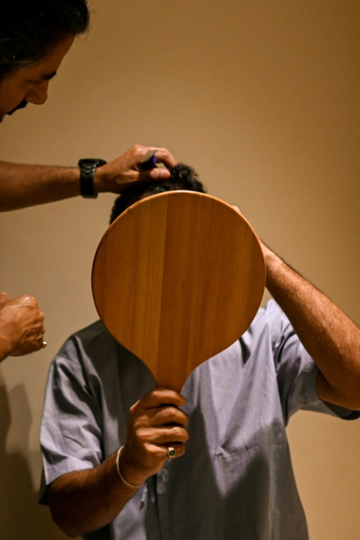 More and more Indian men are opting for hair transplants