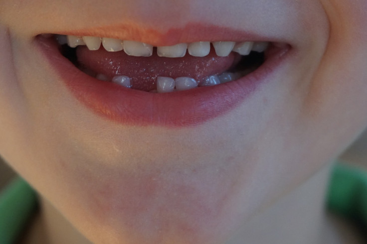 Child, Children, teeth, smile, mouth, tooth,