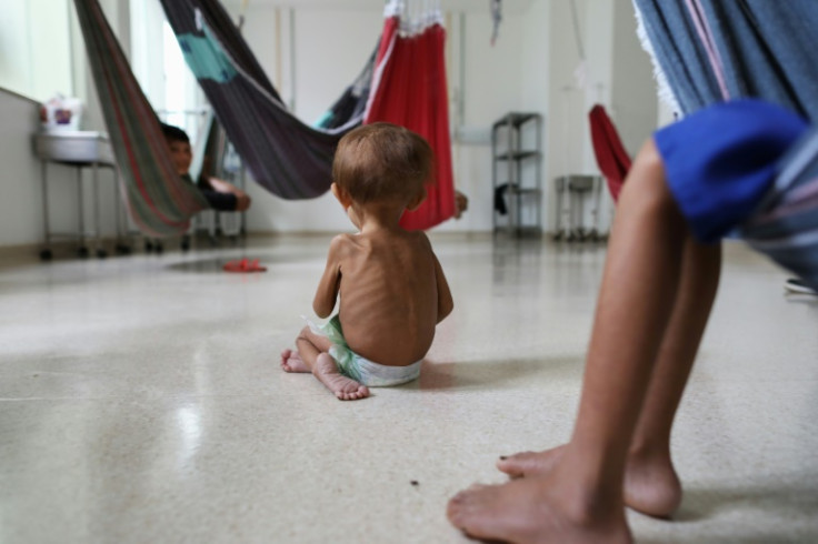 At a hospital in the Brazilian Amazon, Yanomami children are being treated for malnutrition and other ailments