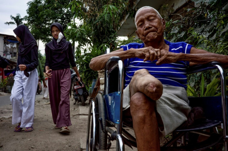 Nearly 500 people who had leprosy now live in Sitanala because it was located behind a hospital that served as the rehabilitation centre for patients