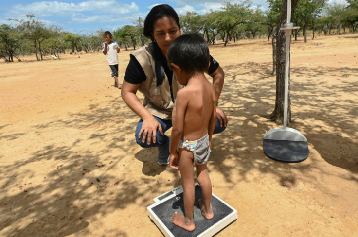 Wilmer Epinayu is seven but weighs as much as a one-year-old
