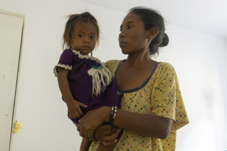 Rosalinda, 2, is one of many children in Colombia's La Guajira department not getting enough to eat