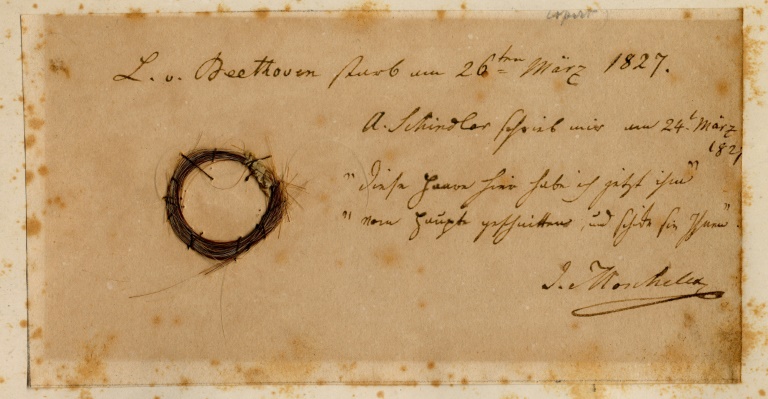 DNA Analysis Of Beethoven's Hair Provides Clues To His Death | IBTimes