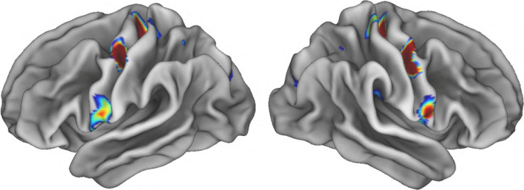 Three colored spots on each half of the brain illuminate special locations in the movement areas of the brain