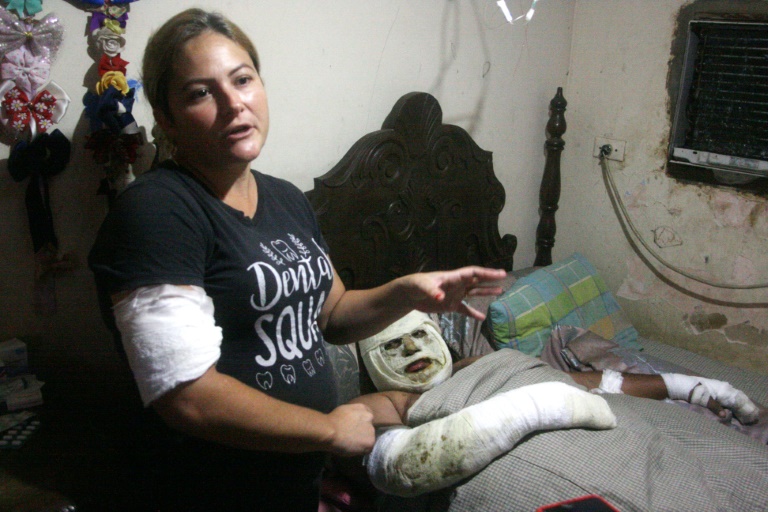 In Venezuela, Cars That Erupt In Flames Have Drivers On Edge - Vimarsana News