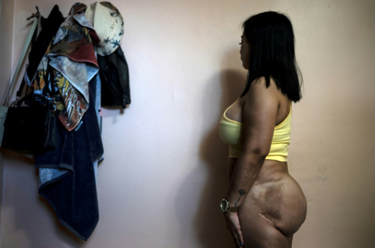 A woman who asked for her name not to be used shows the scars left by an operation to remove biopolymers injected into her buttocks