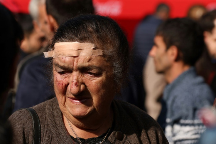 An elderly woman with a head wound she said she got in a car accident as her family fled from Nagorno-Karabakh