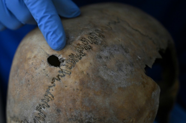 Colombian forensic Hadaluz Osorio examines a skull where the neat entry and explosive exit of a bullet is clearly seen