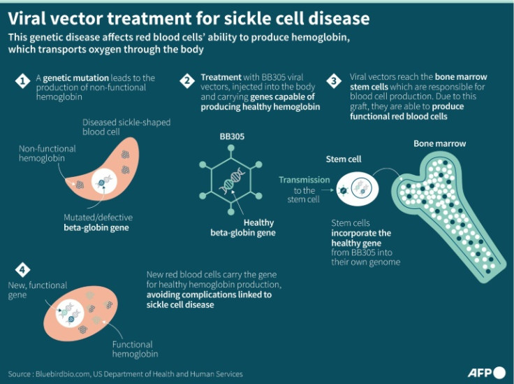 Viral vector treatment has been trialed as a way to treat sickle cell disease