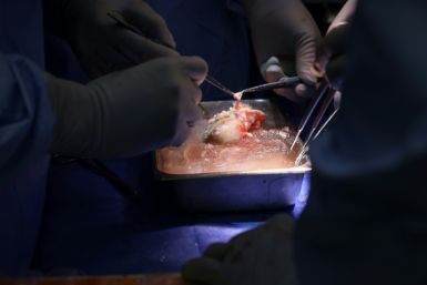 In this image courtesy of Massachusetts General Hospital, surgeons prepare a pig kidney for transplant into a living patient