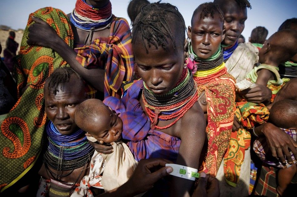 Millions of Malnourished Children in Horn of Africa are at Risk of Dying