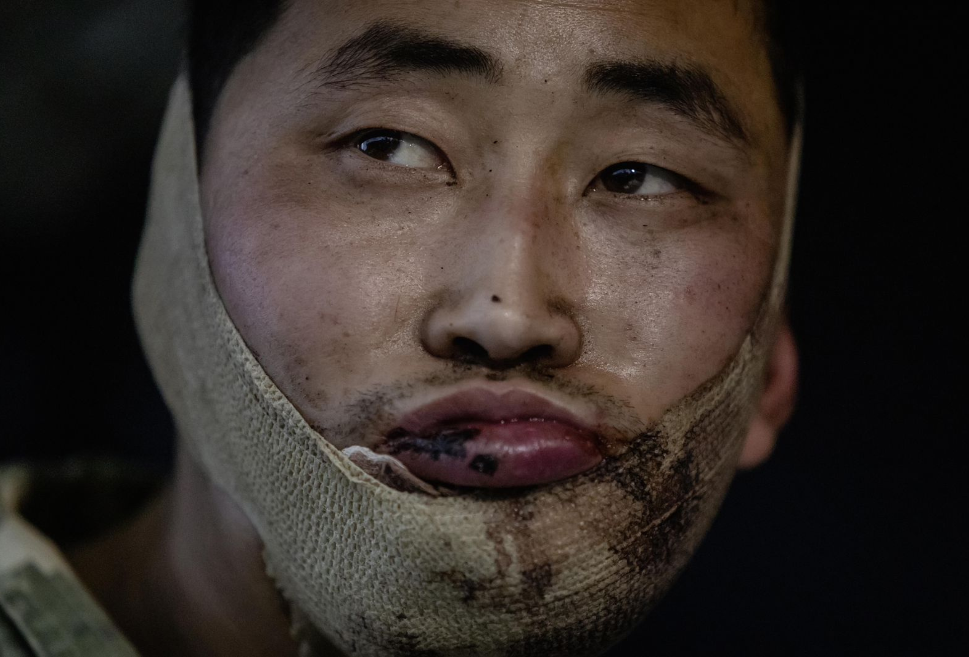 Zelensky Says Ukraine Captured 2 North Korean Soldiers, Shares Photos on Social Media Zelensky Says Ukraine Captured 2 North Korean Soldiers, Shares Photos on Social Media