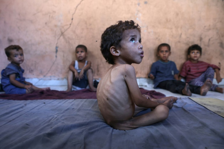 'We are now witnessing a deadly surge in malnutrition-related deaths,' said Tedros