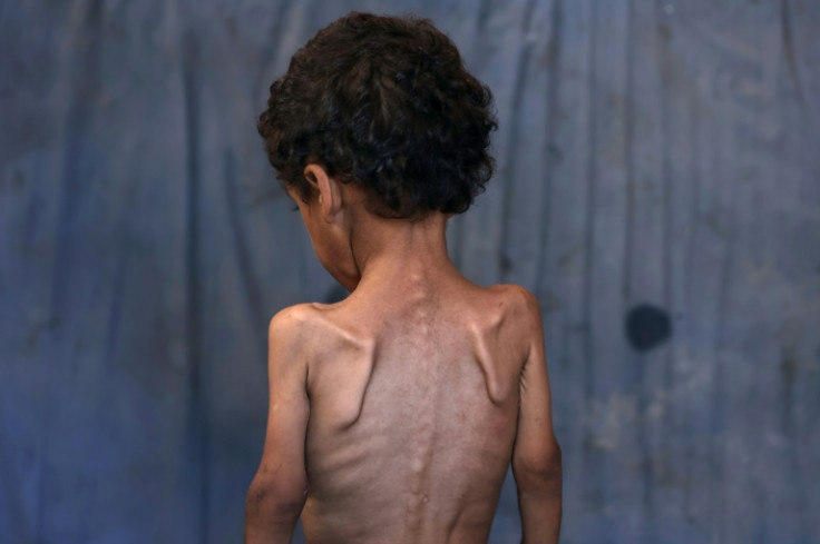 Aid and human rights groups warn 'mass starvation' is spreading in Gaza