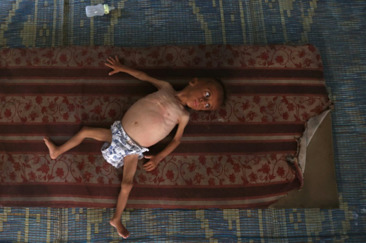 Mohammed al-Mutawaq, an 18-month-old Palestinian boy, inside a tent in the Al-Shati refugee camp west of Gaza City, on July 24, 2025