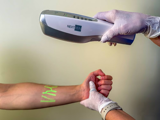 NextVein