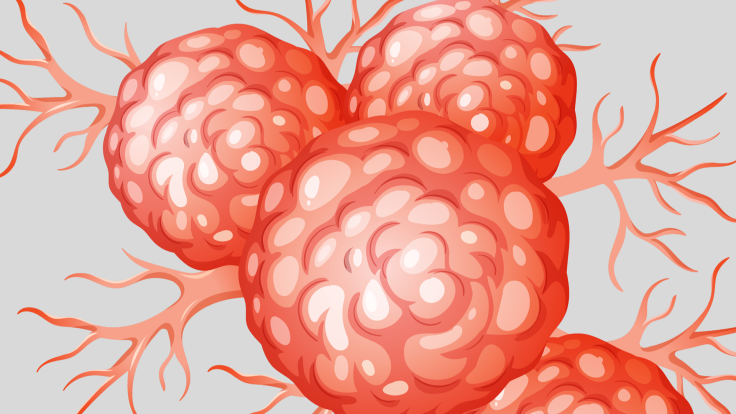 Pancreatic Cancer cure