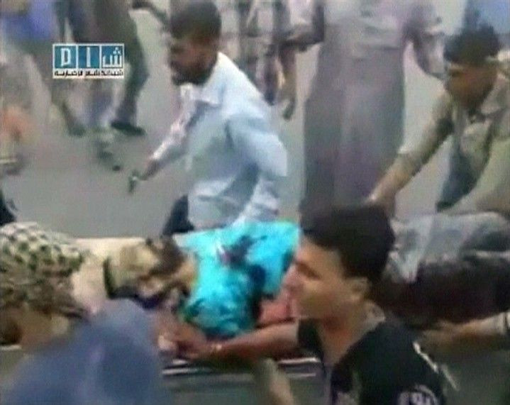 Injured protester carried to hospital