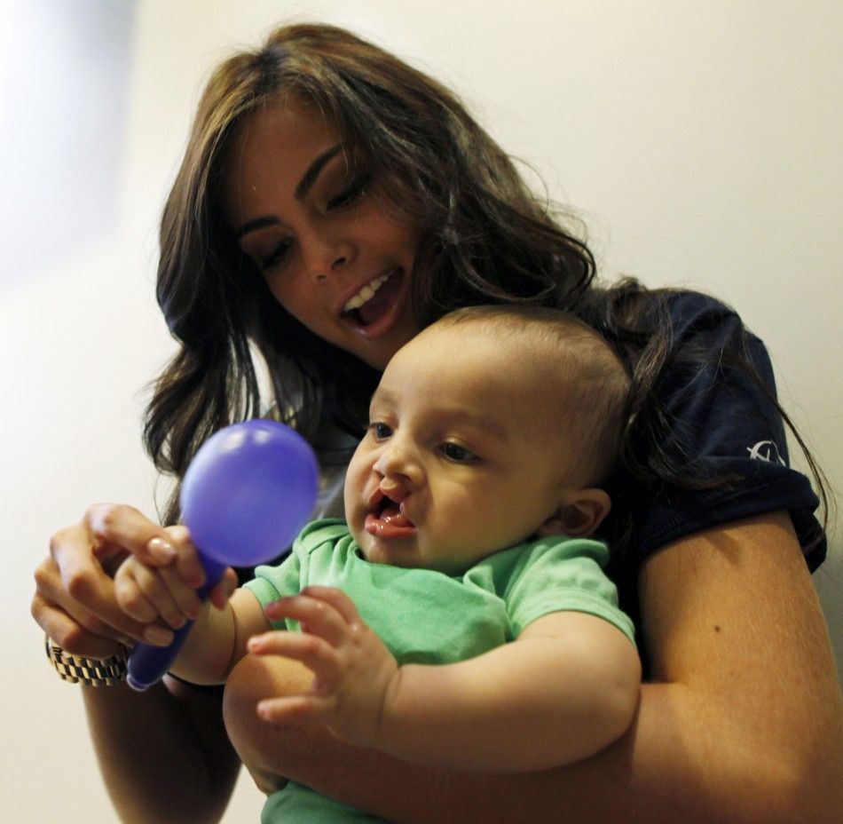 Miss Universe Venezuela 2011 Vanessa Goncalves carries a child with a cleft lip at a hospital during the quotOperation Smilequot event in Sao Paulo