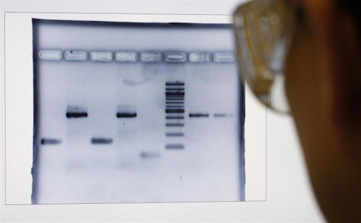 Senior scientist Murat looks at DNA fingerprints of truffles at a laboratory of the INRA in Champenoux near Nancy