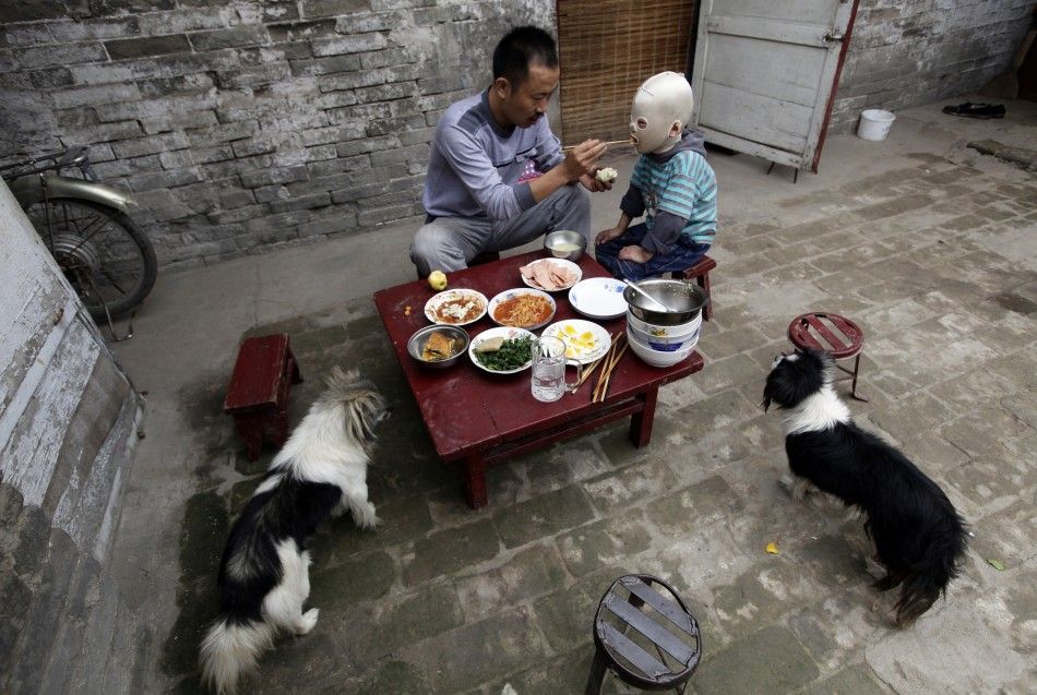 Wang Gengxiang, known as quotMasked Boyquot, is fed by his father Wang Shouwu during breakfast