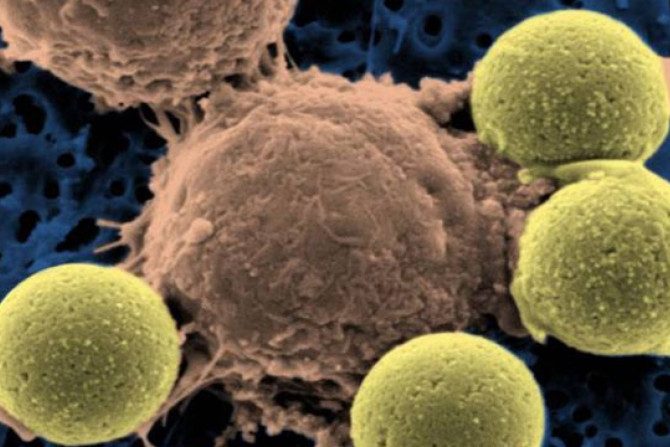 New therapy to wipe out leukemia