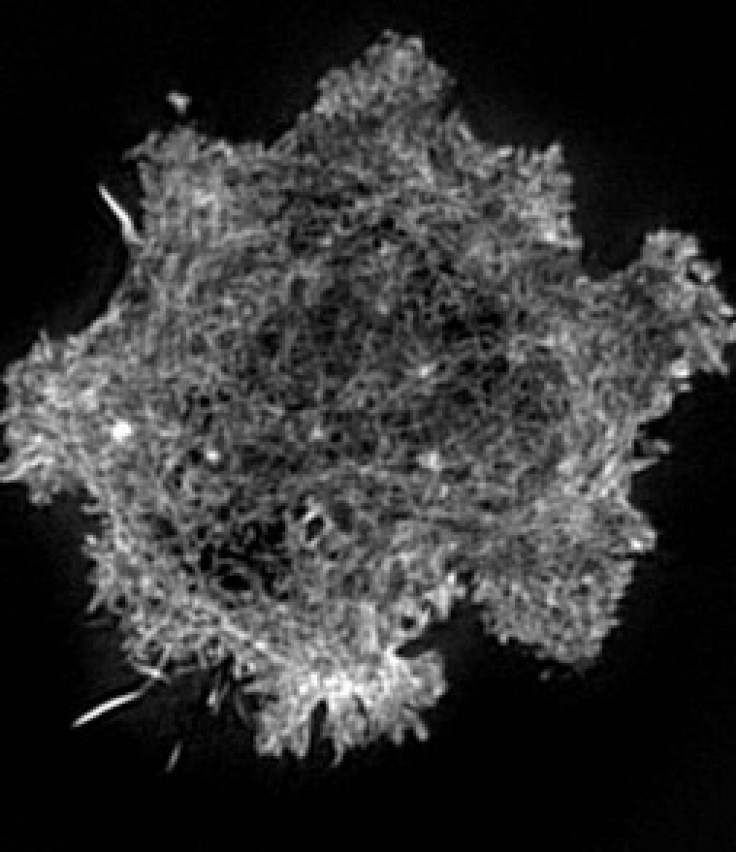 Detail of the actin filaments inside an NK cell