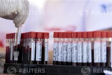 Scientists Suggests New Blood Test To Detect Heart Attacks