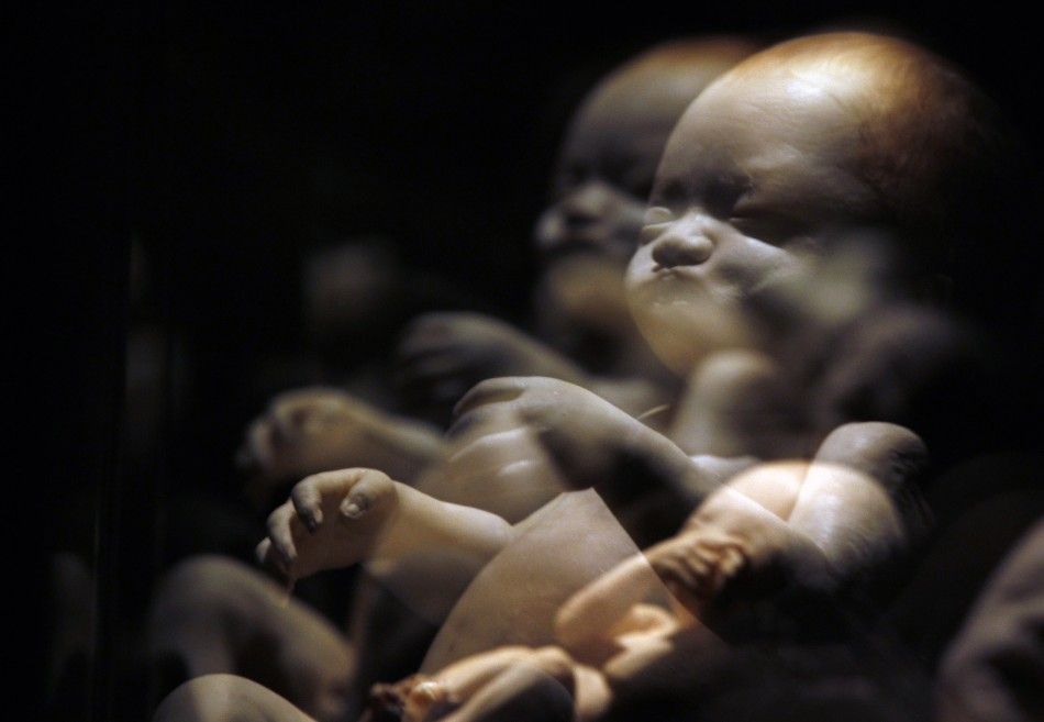 A plastinated foetus is seen during the exhibition quotBody Worldsquot by Gunther von Hagen in Rome