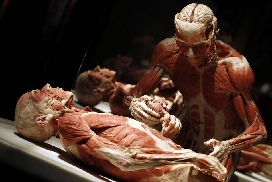 Two plastinated human bodies posed in a surgery scene are seen during the exhibition quotBody Worldsquot by Gunther von Hagen in Rome 