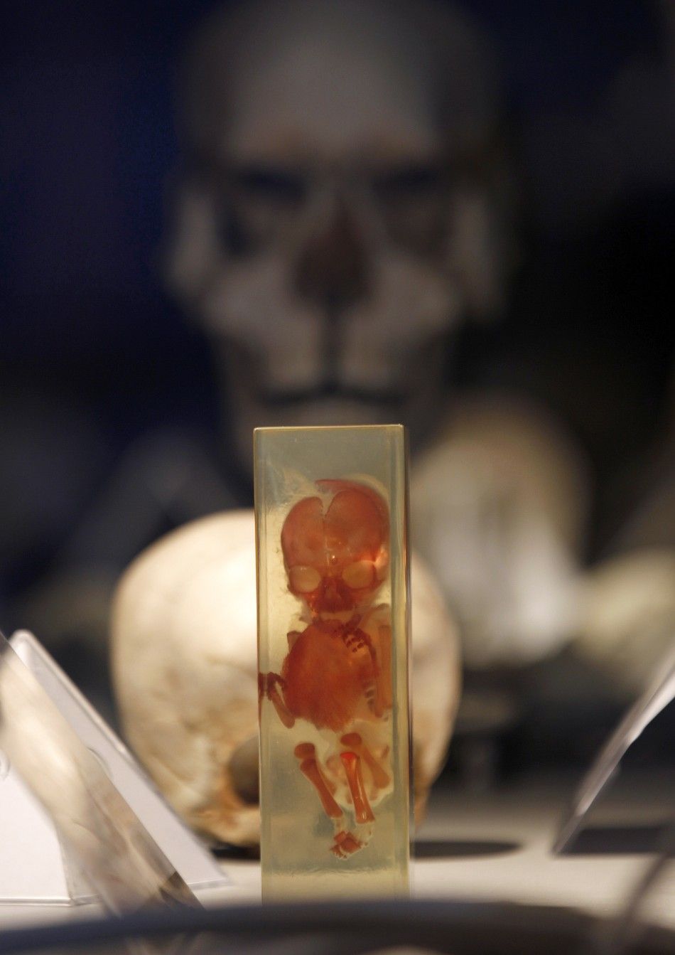 A plastinated skeleton of a five-month-old foetus is seen during the exhibition quotBody Worldsquot by Gunther von Hagen in Rome