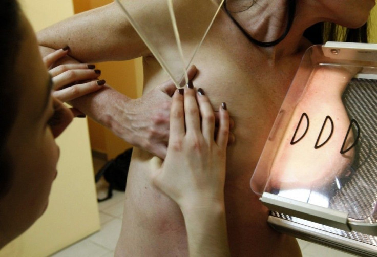 A woman undergoes a mammography exam, a special type of X-ray of the breasts, which is used to detect tumours as part of a regular cancer prevention medical check-up at a clinic in Nice