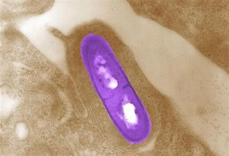 Listeria bacteria in a microscopic image courtesy of the Centers for Disease Control and Prevention.