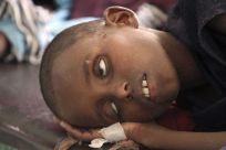 A displaced child who has cholera.