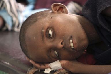 A displaced child who has cholera.