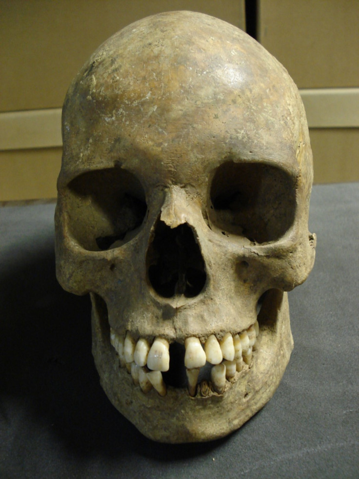 A skull from the East Smithfield plague pits in London