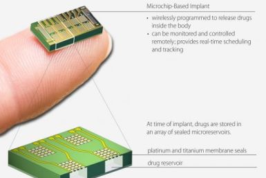 Microchip delivers bone loss drug